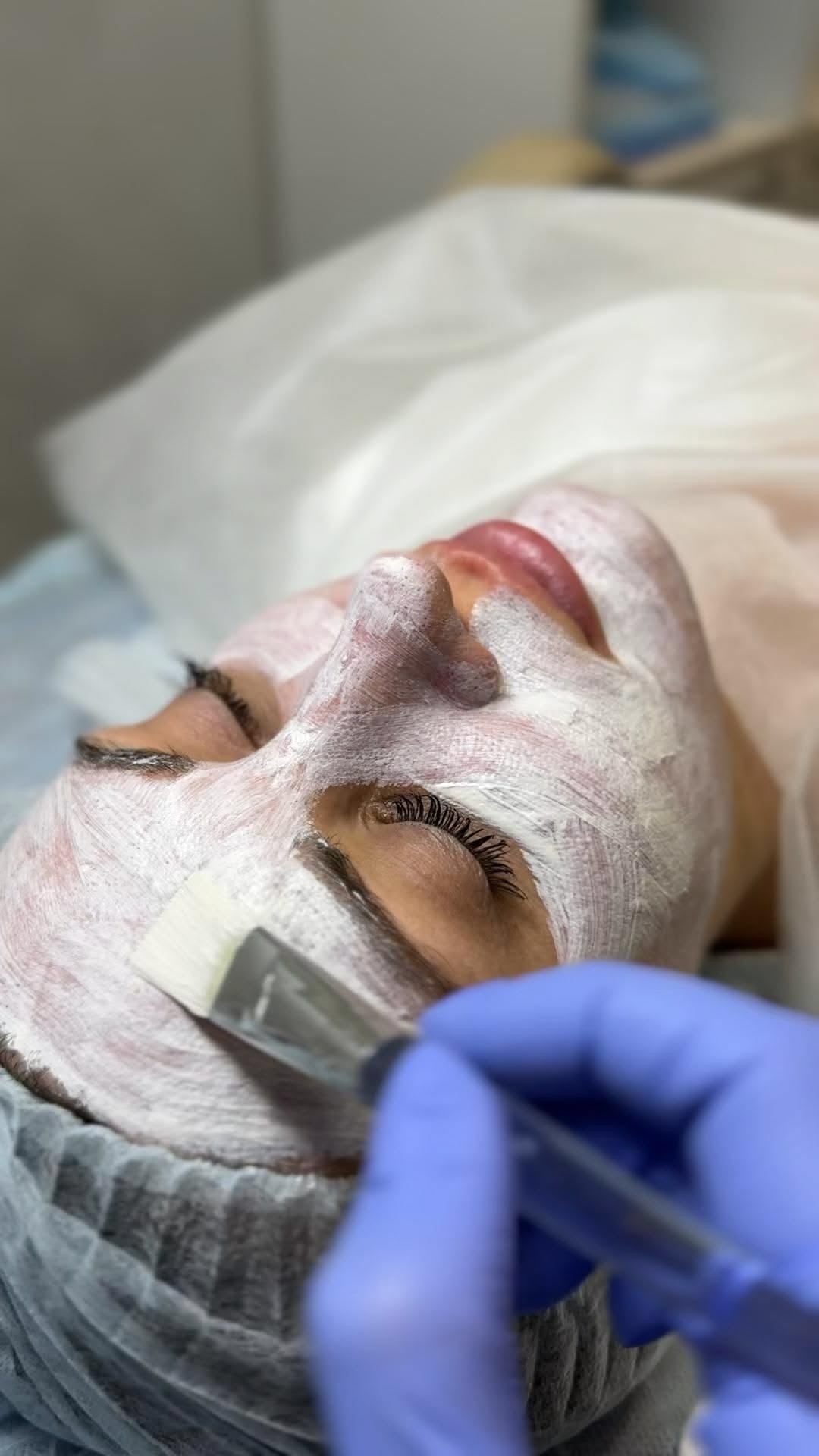 Hydrafacial